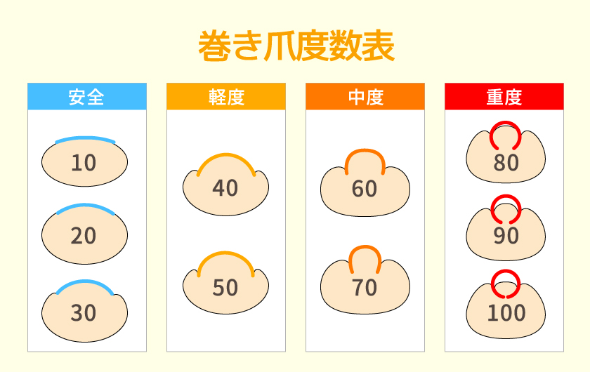 巻き爪度数の測り方